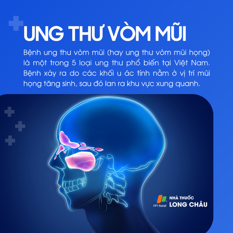 Infographic về các nguyên nhân chính gây mũi bị đau rát bên trong